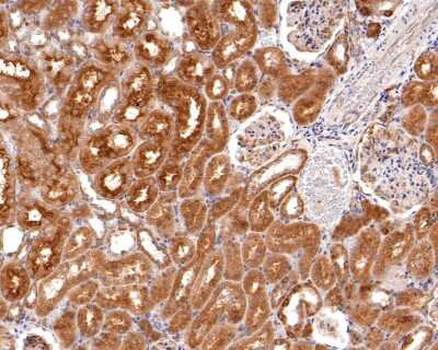 Immunohistochemistry-Paraffin: ABCF1 Antibody (SN07-12) [NBP2-67698] - Analysis of paraffin-embedded rat kidney tissue using anti-ABCF1 antibody. The section was pre-treated using heat mediated antigen retrieval with sodium citrate buffer (pH 6.0) for 20 minutes. The tissues were blocked in 1% BSA for 30 minutes at room temperature, washed with ddH2O and PBS, and then probed with the primary antibody 1/400) for 30 minutes at room temperature. The detection was performed using an HRP conjugated compact polymer system. DAB was used as the chromogen. Tissues were counterstained with hematoxylin and mounted with DPX.