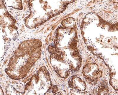 Immunohistochemistry-Paraffin: ABCF1 Antibody (SN07-12) [NBP2-67698] - Analysis of paraffin-embedded human prostate tissue using anti-ABCF1 antibody. The section was pre-treated using heat mediated antigen retrieval with sodium citrate buffer (pH 6.0) for 20 minutes. The tissues were blocked in 1% BSA for 30 minutes at room temperature, washed with ddH2O and PBS, and then probed with the primary antibody (1/400) for 30 minutes at room temperature. The detection was performed using an HRP conjugated compact polymer system. DAB was used as the chromogen. Tissues were counterstained with hematoxylin and mounted with DPX.