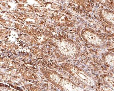 Immunohistochemistry-Paraffin: ABCF1 Antibody (SN07-12) [NBP2-67698] - Analysis of paraffin-embedded human stomach tissue using anti-ABCF1 antibody. The section was pre-treated using heat mediated antigen retrieval with sodium citrate buffer (pH 6.0) for 20 minutes. The tissues were blocked in 1% BSA for 30 minutes at room temperature, washed with ddH2O and PBS, and then probed with the primary antibody 1/400) for 30 minutes at room temperature. The detection was performed using an HRP conjugated compact polymer system. DAB was used as the chromogen. Tissues were counterstained with hematoxylin and mounted with DPX.