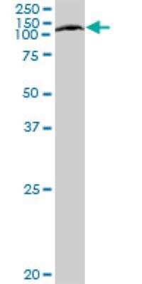 Western Blot: ABCF1 Antibody [H00000023-B01P] - Analysis of ABCF1 expression in HepG2.