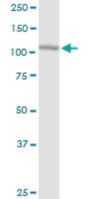 Western Blot: ABCF1 Antibody [H00000023-B01P] - Analysis of ABCF1 expression in HeLa.