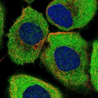 Immunocytochemistry/Immunofluorescence: ABCF2 Antibody [NBP1-89317] - Immunofluorescent staining of human cell line A-431 shows localization to cytosol.