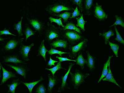 Immunocytochemistry/Immunofluorescence: ABCF2 Antibody [NBP2-98977] - Immunofluorescence staining of ABCF2 in HeLa cells. Cells were fixed with 4% PFA, permeabilzed with 0.1% Triton X-100 in PBS, blocked with 10% serum, and incubated with rabbit anti-Human ABCF2 polyclonal antibody (dilution ratio 1:1000) at 4C overnight. Then cells were stained with the Alexa Fluor(R)488-conjugated Goat Anti-rabbit IgG secondary antibody (green) and counterstained with DAPI (blue).Positive staining was localized to Cytoplasm.