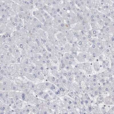 Immunohistochemistry-Paraffin: ABCF2 Antibody [NBP1-89316] - Staining of human liver shows low expression as expected.