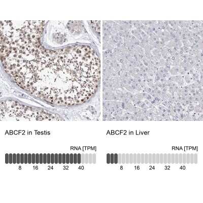 <b>Independent Antibodies Validation and Orthogonal Strategies Validation.</b>Immunohistochemistry-Paraffin: ABCF2 Antibody [NBP1-89316] - Staining in human testis and liver tissues using anti-ABCF2 antibody. Corresponding ABCF2 RNA-seq data are presented for the same tissues.