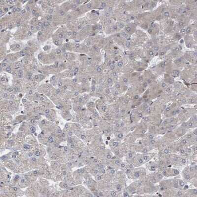 Immunohistochemistry-Paraffin: ABCF2 Antibody [NBP1-89317] - Staining of human liver shows low expression as expected.