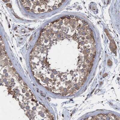 Immunohistochemistry-Paraffin: ABCF2 Antibody [NBP1-89317] - Staining of human testis shows high expression.