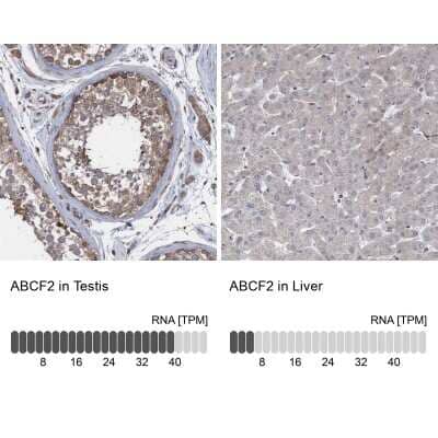 Immunohistochemistry-Paraffin: ABCF2 Antibody [NBP1-89317] - Staining in human testis and liver tissues using anti-ABCF2 antibody. Corresponding ABCF2 RNA-seq data are presented for the same tissues.