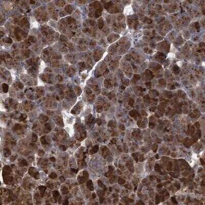 Immunohistochemistry-Paraffin: ABCF2 Antibody [NBP1-89318] - Staining of human pancreas shows strong cytoplasmic positivity in exocrine glandular cells.