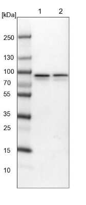 Western Blot: ABCF2 Antibody [NBP1-89316] - Lane 1: NIH-3T3 cell lysate (Mouse embryonic fibroblast cells). Lane 2: NBT-II cell lysate (Rat Wistar bladder tumor cells).