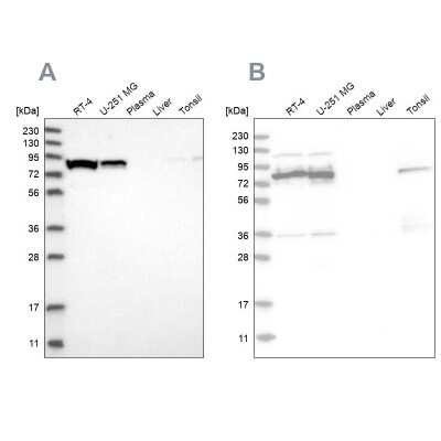 Western Blot: ABCF2 Antibody [NBP1-89316] - Analysis using Anti-ABCF2 antibody NBP1-89316 (A) shows similar pattern to independent antibody NBP1-89317 (B).