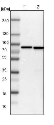 Western Blot: ABCF2 Antibody [NBP1-89317] - Lane 1: NIH-3T3 cell lysate (Mouse embryonic fibroblast cells). Lane 2: NBT-II cell lysate (Rat Wistar bladder tumor cells).