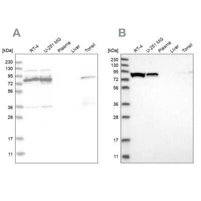 <b>Independent Antibodies Validation and Orthogonal Strategies Validation.</b>Western Blot: ABCF2 Antibody [NBP1-89317] - Analysis using Anti-ABCF2 antibody NBP1-89317 (A) shows similar pattern to independent antibody NBP1-89316 (B).