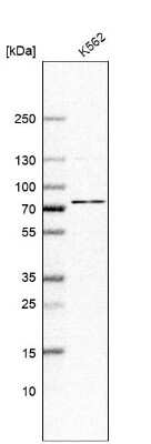 Western Blot: ABCF2 Antibody [NBP1-89318] - Analysis in human cell line K562.