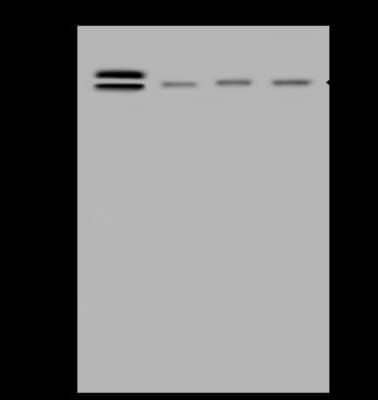 Western Blot: ABCF2 Antibody [NBP2-98977] - Anti-ABCF2 rabbit polyclonal antibody at 1:500 dilution. Lane A: HeLa Whole Cell Lysate Lane B: 293T Whole Cell Lysate Lane C: HepG2 Whole Cell Lysate Lane D: K562 Whole Cell Lysate Lysates/proteins at 30 ug per lane. Secondary Goat Anti-Rabbit IgG (H+L)/HRP at 1/10000 dilution. Developed using the ECL technique. Performed under reducing conditions. Predicted band size: 71 kDa. Observed band size: 71 kDa