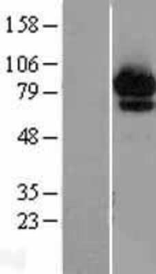 Western Blot ABCF2 Overexpression Lysate