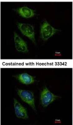 Immunocytochemistry/Immunofluorescence: ABCF3 Antibody [NBP2-15227] - Analysis of methanol-fixed HeLa, using antibody at 1:500 dilution.