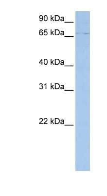 Western Blot: ABCF3 Antibody [NBP1-59381] - MCF-7 whole cell lysates, concentration 0.2-1 ug/ml.