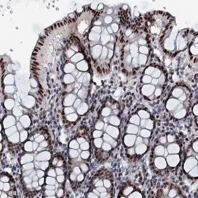 Immunohistochemistry-Paraffin: ABCG4 Antibody [NBP2-14252] - Staining of human colon shows strong nuclear positivity in glandular cells.