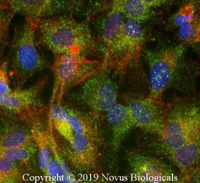 Immunocytochemistry/Immunofluorescence: ABCG8 Antibody (1B10A5) - Azide and BSA Free [NBP2-80560] - HepG2 cells were fixed for 10 minutes using 10% formalin and then permeabilized for 5 minutes using 1X PBS + 0.1% Saponin. The cells were incubated with anti-ABCG8 Antibody (1B10A5) at 2 ug/ml overnight at 4C and detected with an anti-mouse Dylight 488 (Green) at a 1:500 dilution. Actin was detected with Phalloidin 568 (Red) at a 1:200 dilution. Nuclei were counterstained with DAPI (Blue). Cells were imaged using a 40X objective. Image from the standard format of this antibody.