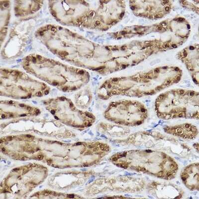 Immunohistochemistry-Paraffin ABH1 Antibody (5K4W5)