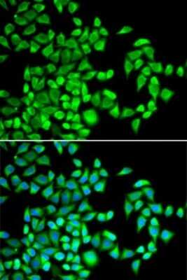 Immunocytochemistry/Immunofluorescence: ABH1 Antibody [NBP2-92691] - Analysis of U2OS cells using ABH1 . Blue: DAPI for nuclear staining.