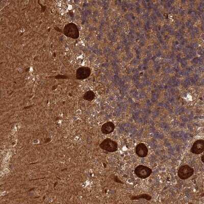 Immunohistochemistry-Paraffin: ABH1 Antibody [NBP2-14283] - Staining of human cerebellum shows strong cytoplasmic and nuclear positivity in Purkinje cells.