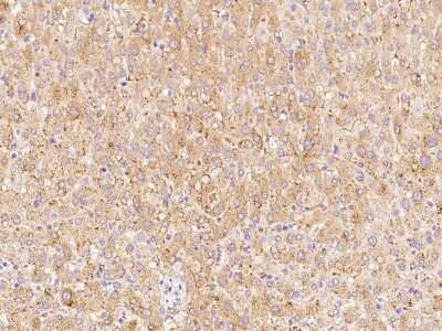 Immunohistochemistry-Paraffin: ABH1 Antibody [NBP2-98658] - Immunochemical staining of human ABH1 in human liver with rabbit polyclonal antibody at 1:100 dilution, formalin-fixed paraffin embedded sections.