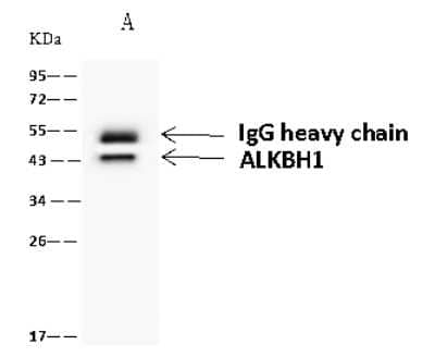 Immunoprecipitation: ABH1 Antibody [NBP2-98658] - ABH1 was immunoprecipitated using: Lane A: 0.5 mg Jurkat Whole Cell Lysate 4 ul anti-ABH1 rabbit polyclonal antibody and 60 ug of Immunomagnetic beads Protein A/G.  Primary antibody: Anti-ABH1 rabbit polyclonal antibody, at 1:100 dilution. Secondary antibody: Goat Anti-Rabbit IgG (H+L)/HRP at 1/10000 dilution. Developed using the ECL technique. Performed under reducing conditions. Predicted band size: 44 kDa. Observed band size: 43 kDa