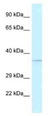 Western Blot: ABH1 Antibody [NBP1-79909] - Human Fetal Kidney Lysate 1ug/ml  Gel Concentration 12%