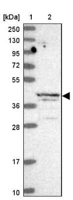 Western Blot: ABH1 Antibody [NBP2-14283] - Lane 1: Marker  [kDa] 250, 130, 95, 72, 55, 36, 28, 17, 10.  Lane 2: Human cell line RT-4