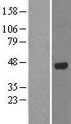 Western Blot ABH1 Overexpression Lysate