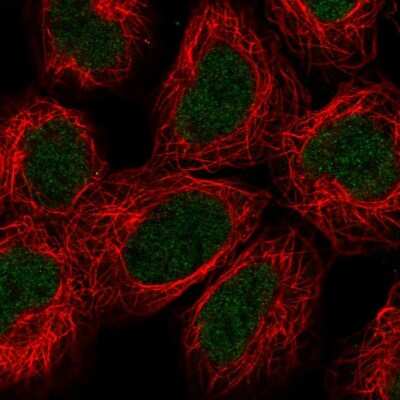 Immunocytochemistry/Immunofluorescence: ABH2 Antibody [NBP2-55544] - Staining of human cell line HEK 293 shows localization to nucleoplasm.