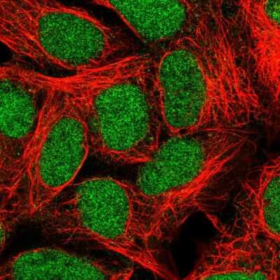 Immunocytochemistry/Immunofluorescence: ABH2 Antibody [NBP2-58047] - Staining of human cell line HEK 293 shows localization to nucleus.