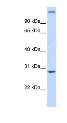 Western Blot: ABH2 Antibody [NBP1-56921] - Human Brain lysate, concentration 0.2-1 ug/ml.