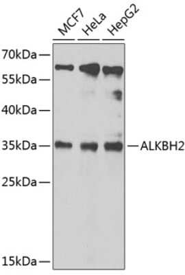 Western Blot: ABH2 Antibody [NBP2-92472] - Analysis of extracts of various cell lines, using ABH2 .Exposure time: 90s.