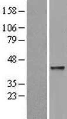 Western Blot: ABH2 Overexpression Lysate (Adult Normal) [NBL1-07473] Left-Empty vector transfected control cell lysate (HEK293 cell lysate); Right -Over-expression Lysate for ABH2.