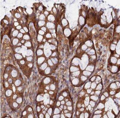 Immunohistochemistry-Paraffin ABHD1 Antibody