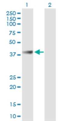 Western Blot: ABHD1 Antibody [H00084696-B01P] - Analysis of ABHD1 expression in transfected 293T cell line by ABHD1 polyclonal antibody.  Lane 1: ABHD1 transfected lysate(44.55 KDa). Lane 2: Non-transfected lysate.