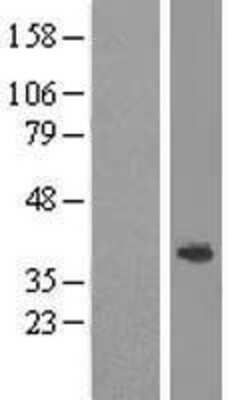 Western Blot: ABHD1 Overexpression Lysate (Adult Normal) [NBP2-05988] Left-Empty vector transfected control cell lysate (HEK293 cell lysate); Right -Over-expression Lysate for ABHD1.