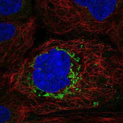 Immunocytochemistry/ Immunofluorescence ABHD10 Antibody - BSA Free