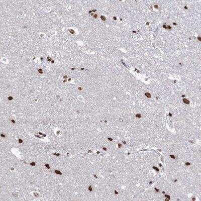 Immunohistochemistry ABHD10 Antibody - BSA Free