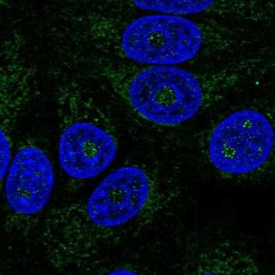 Immunocytochemistry/Immunofluorescence: ABHD11 Antibody [NBP1-87254] - Staining of human cell line MCF7 shows localization to nucleoli fibrillar center & mitochondria.