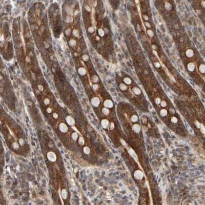 Immunohistochemistry-Paraffin: ABHD11 Antibody [NBP1-87254] - Staining of human duodenum shows strong cytoplasmic positivity in glandular cells.