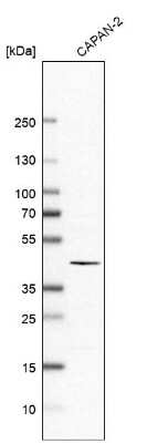 Western Blot ABHD11 Antibody - BSA Free