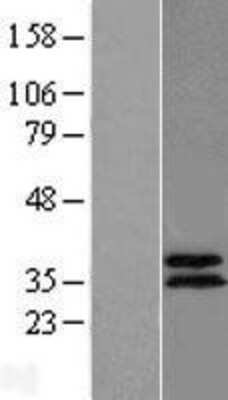 Western Blot: ABHD11 Overexpression Lysate (Adult Normal) [NBL1-07190] Left-Empty vector transfected control cell lysate (HEK293 cell lysate); Right -Over-expression Lysate for ABHD11.