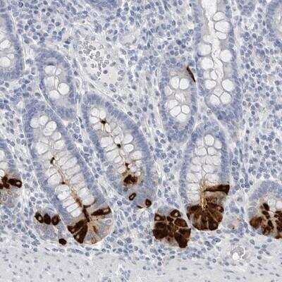 Immunohistochemistry-Paraffin ABHD12 Antibody