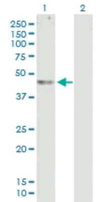 Western Blot: ABHD12 Antibody [H00026090-B01P] - Analysis of ABHD12 expression in transfected 293T cell line by ABHD12 polyclonal antibody.  Lane 1: C20orf22 transfected lysate(44.44 KDa). Lane 2: Non-transfected lysate.