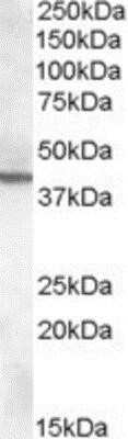 Western Blot ABHD12 Antibody