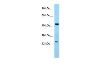 Western Blot: ABHD12 Antibody [NBP2-86941] - WB Suggested Anti-Abhd12 Antibody. Titration: 1.0 ug/ml. Positive Control: Mouse Thymus